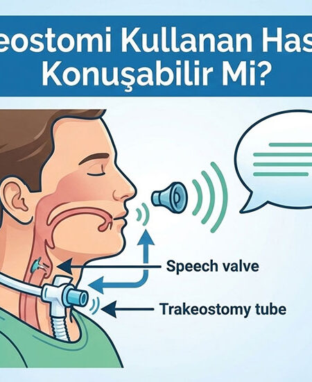 trakeostomi kullanan hastalar konuşabilir mi?